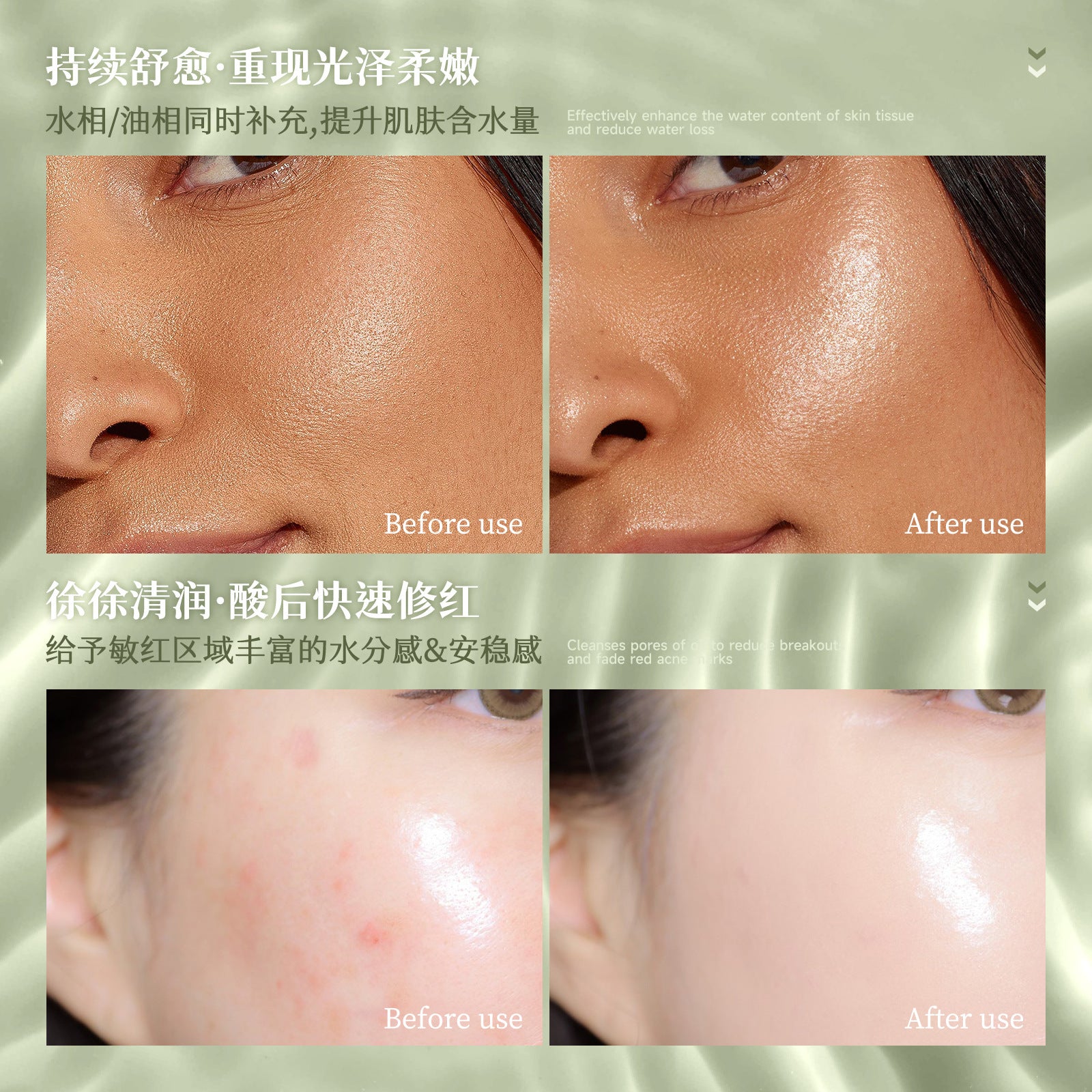 SHELOVES Aloe Vera Rejuvenating Soothing Stick After Sun Redness Sensitive Skin Repair Hydrating Moisturizing Gel Cream