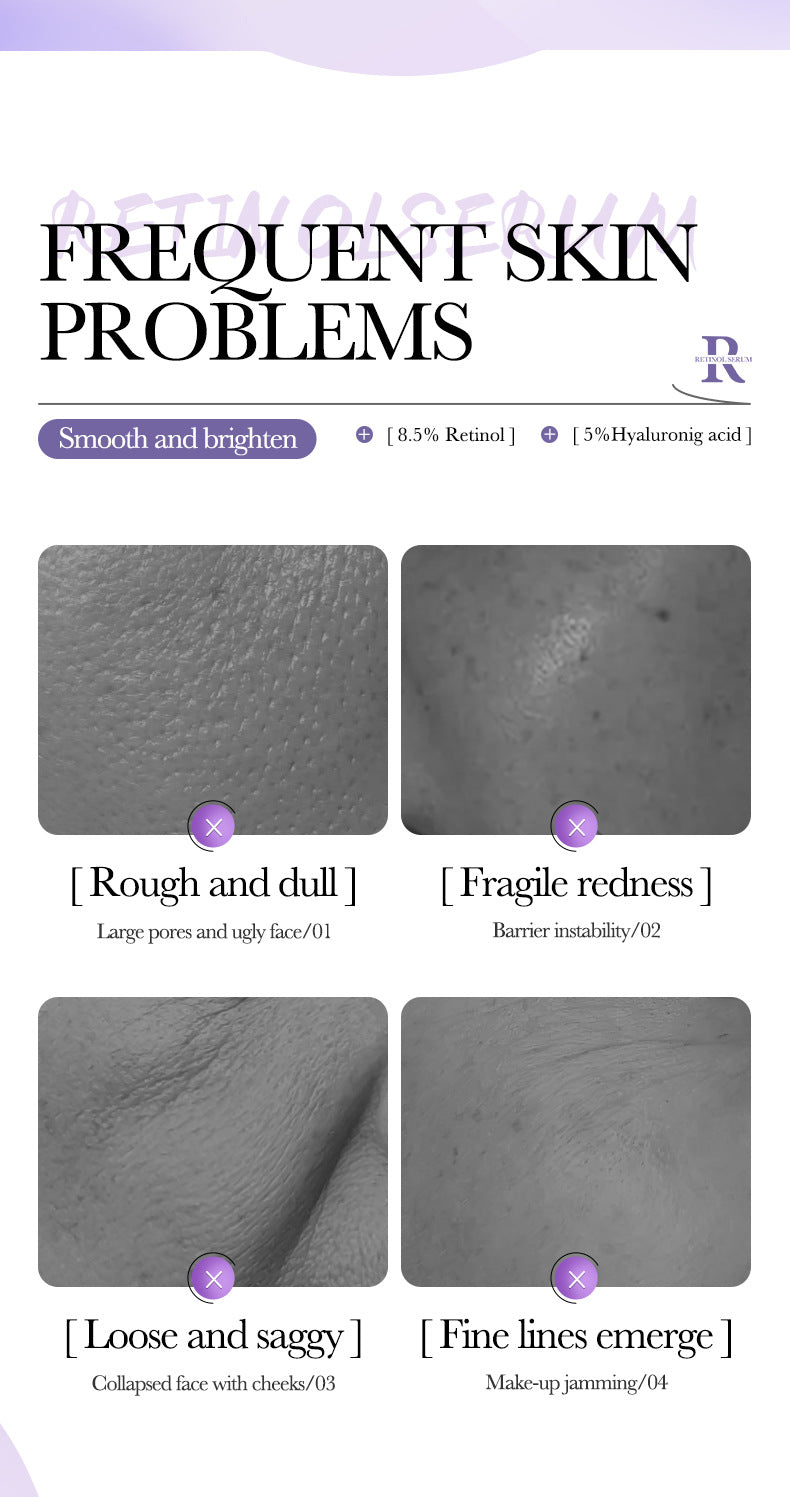 BIOAOUA Essence Series Hydrating and Nourishing Vitamins C Essence   Factory Direct Sales