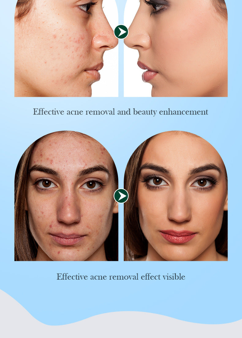 Tea Tree Skincare Set SADOER Cleansing, moisturizing, hydrating five-piece set for  foreign trade wholesale