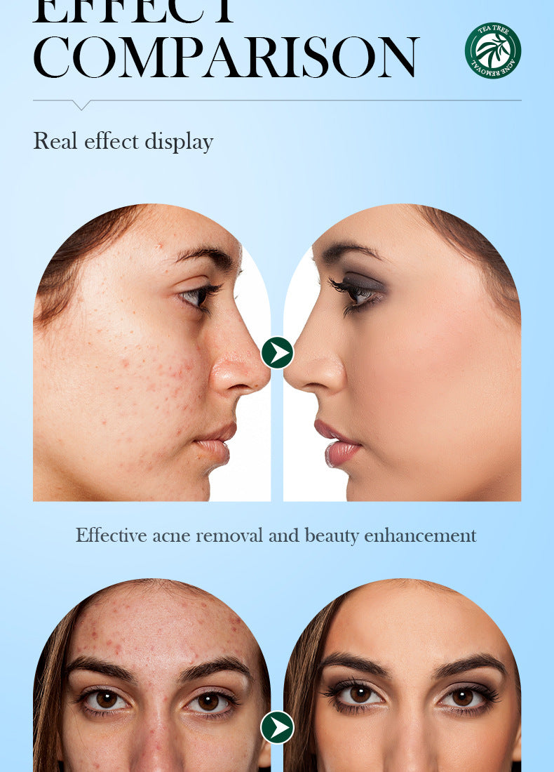 Tea Tree Skincare Set SADOER Cleansing, moisturizing, hydrating five-piece set for  foreign trade wholesale