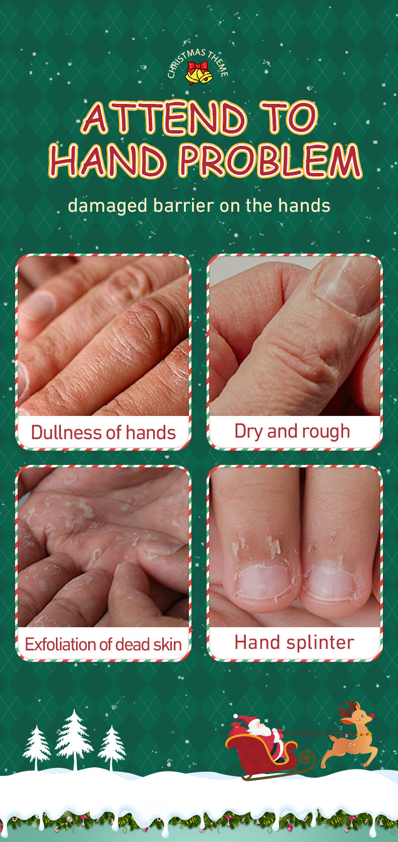 Christmas Moisturizing Anti-Chapped Hand Cream Five-Piece Set SADOER Autumn and winter hand cream  foreign trade wholesale