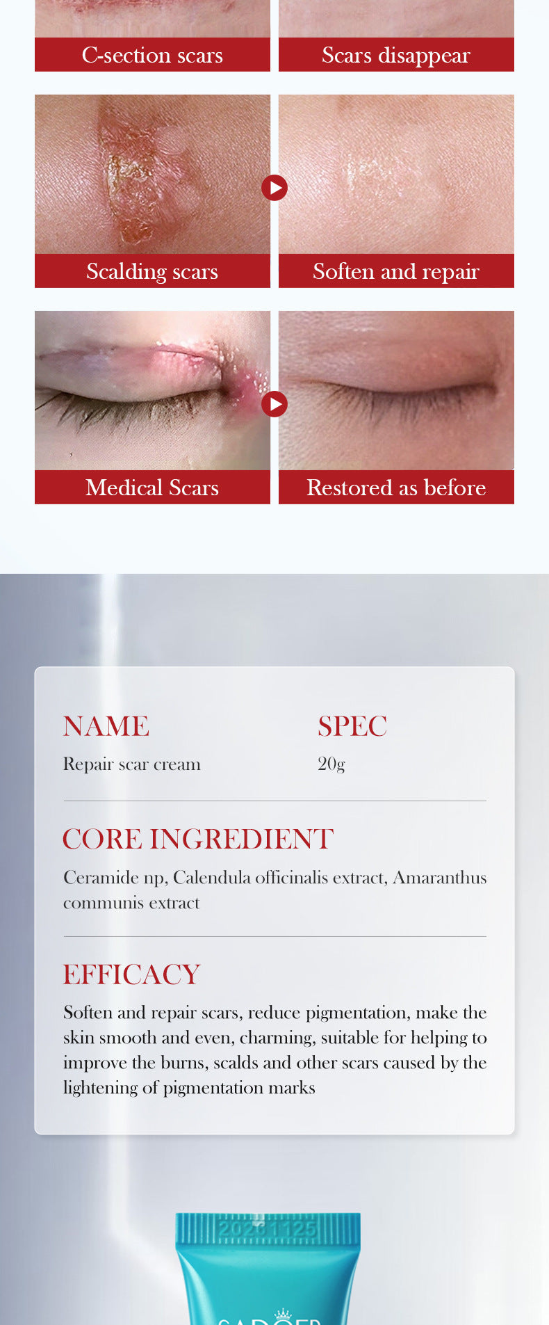 Scar Serum SADOER Hydrating, moisturizing, rejuvenating, nourishing face cream  foreign trade wholesale