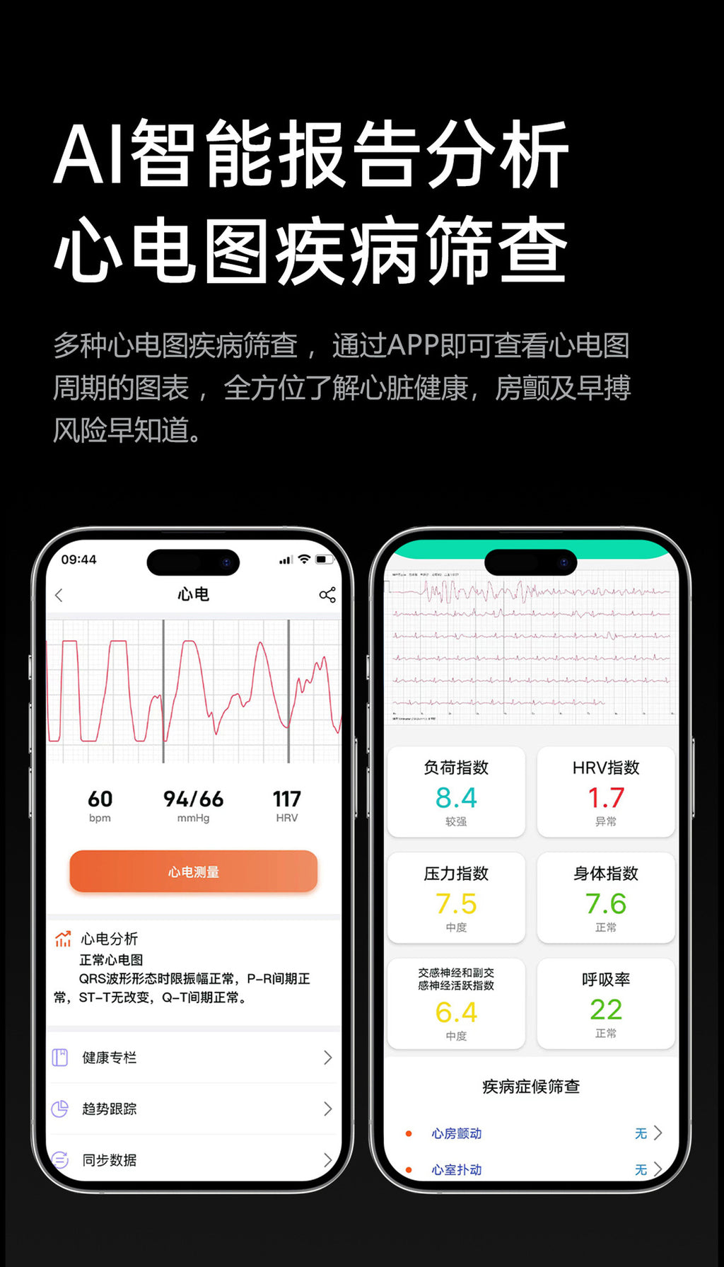 tk66Smart watch with precise air pump for blood pressure and ECG measurement amoled High-end Gift Smart Watch