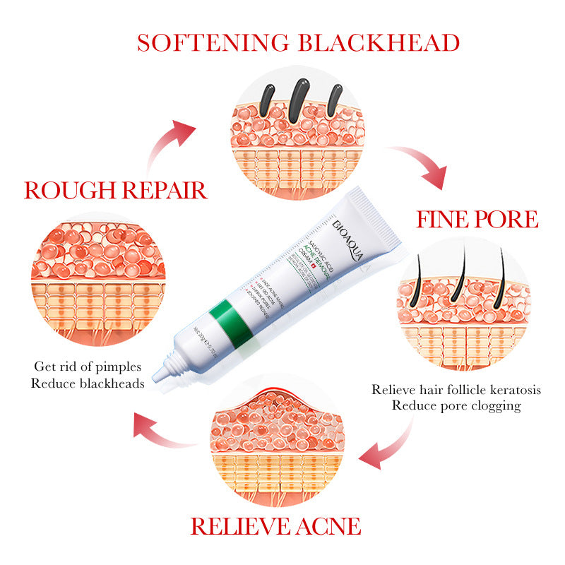 Cream BIOAOUA Salicylic Acid Moisturizing Hydrating Fading Acne Marks  Wholesale
