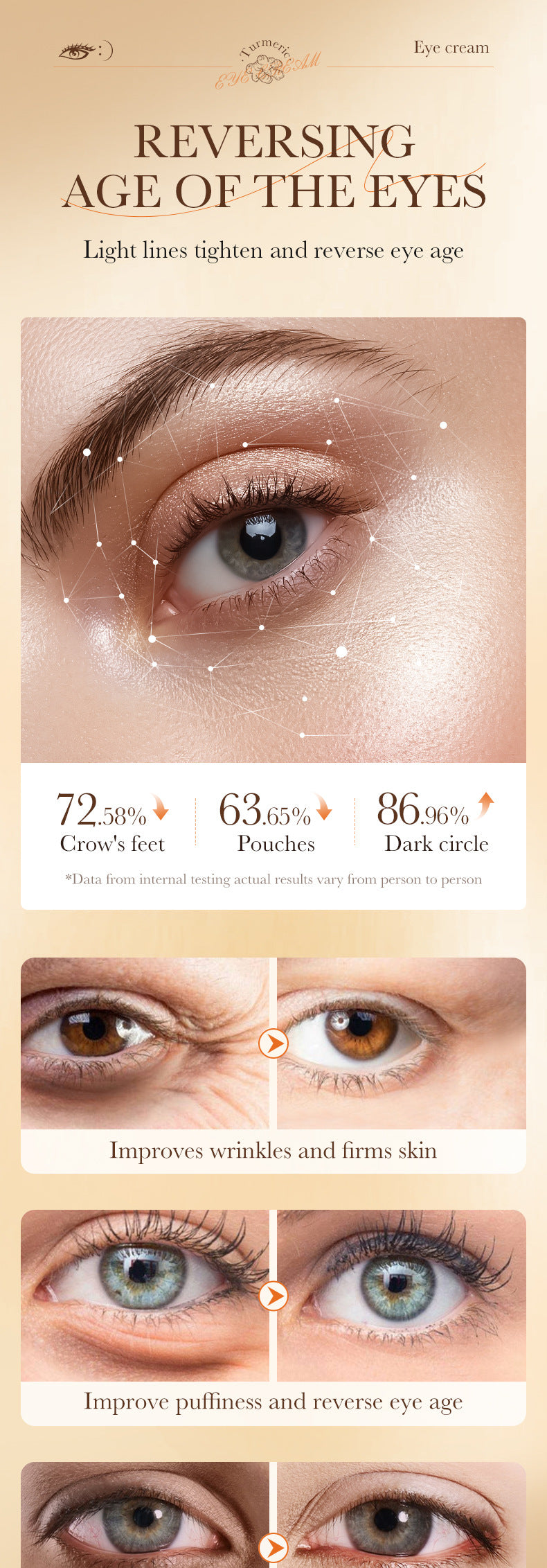 Turmeric Eye Cream SADOER Moisturize and Improve Dark Circles, Eye Lines, Eye Bags,  Wholesale